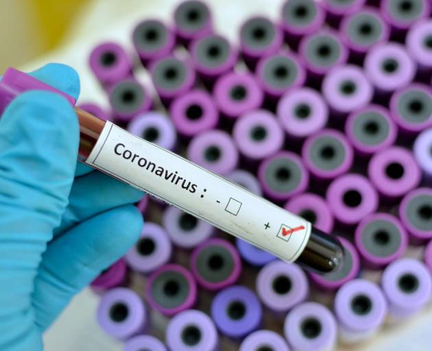 Australia phát triển thành công phiên bản virus corona mới trong phòng thí nghiệm