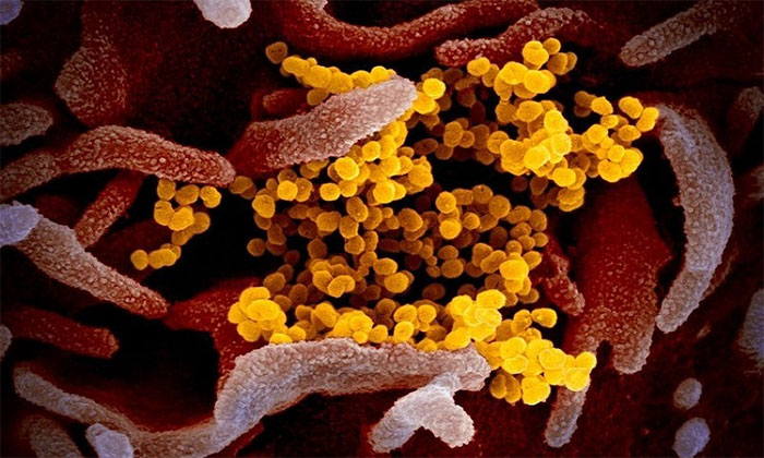 nCoV (màu vàng) khu trú giữa các tế bào cơ thể người (màu hồng).