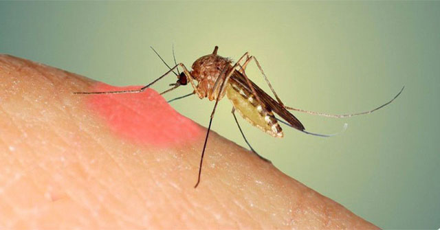 Tại sao bị muỗi đốt lại sưng và ngứa rất lâu?