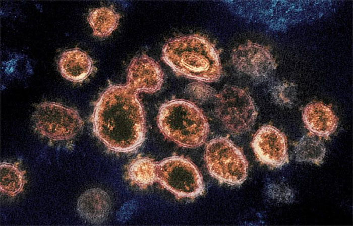 Nghiên cứu mới cho thấy SARS-CoV-2 dễ bám vào tế bào gấp 1.000 lần so với virus SARS.