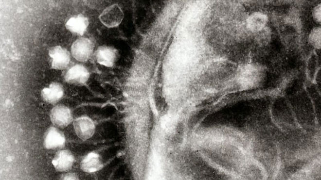 Những virus khổng lồ này thường được tìm thấy trong các con amip.