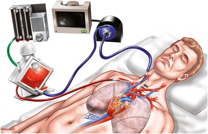 Mô hình thanh quản tim và phổi  httpakitechvn
