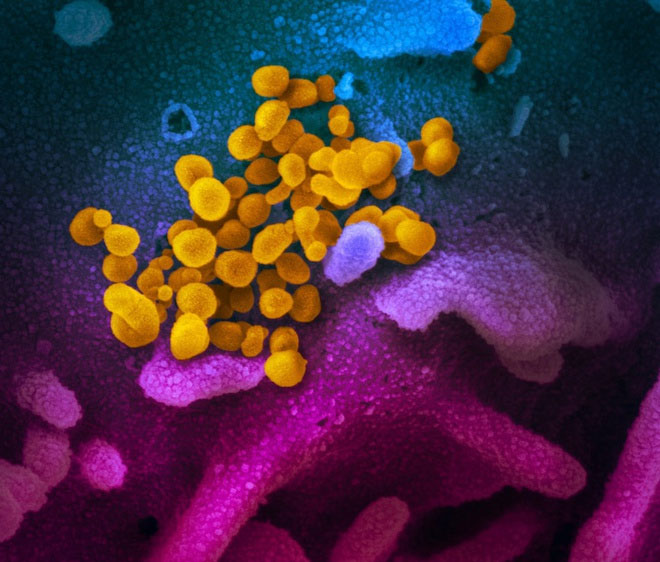 Hình ảnh virus SARS-CoV-2 được nuôi cấy trong phòng thí nghiệm trên kính hiển vi điện tử.