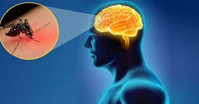 Dấu hiệu nhận biết sớm viêm não Nhật Bản ở trẻ