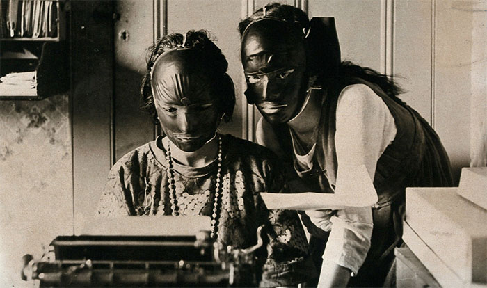 Mặt nạ làm đẹp bằng nhựa