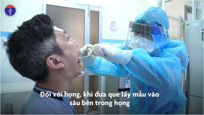Khi lấy mẫu dịch họng, hãy yêu cầu bệnh nhân há miệng to.