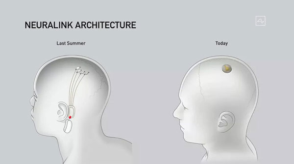 Hệ thống của Neuralink đã được thu gọn bằng đồng xu (bên phải).