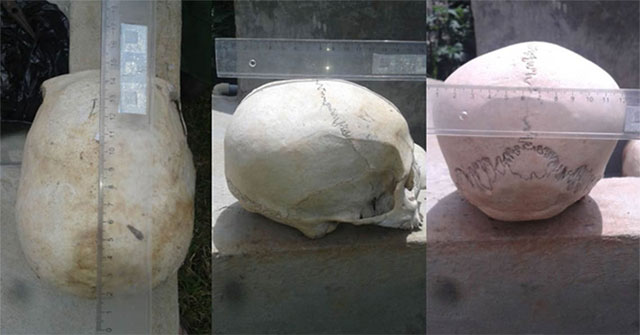 Choáng: Hài cốt người trong "mộ hang động" có hộp sọ như của loài khác