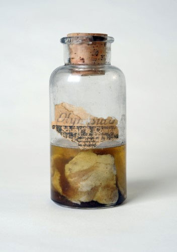 Vật mẫu từ cơn mưa thịt được lưu trữ tại Bảo tàng Khoa học và Y học Moosnick