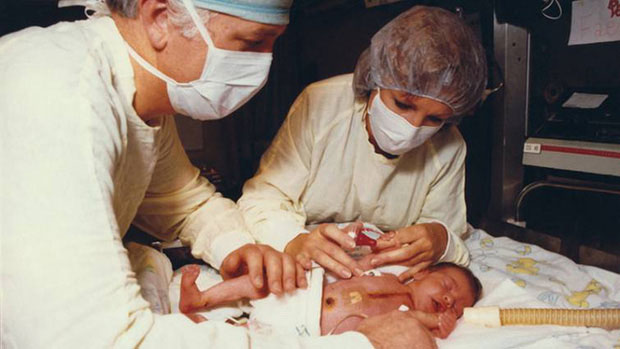 Bé gái sơ sinh sống được 21 ngày sau khi ghép tim khỉ.