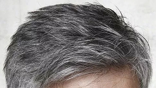 Nguyên nhân bạc tóc chủ yếu do quá trình lão hóa tự nhiên và gene