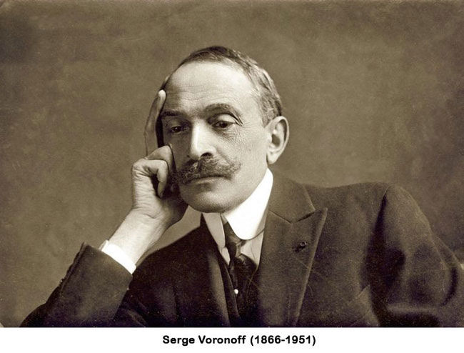 Serge Voronoff