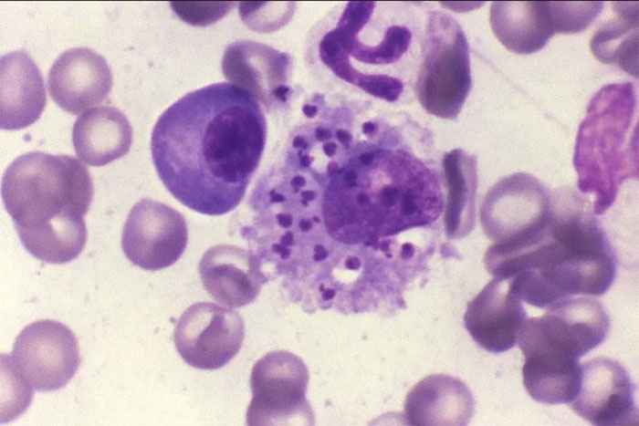Ký sinh trùng Leishmania donovani